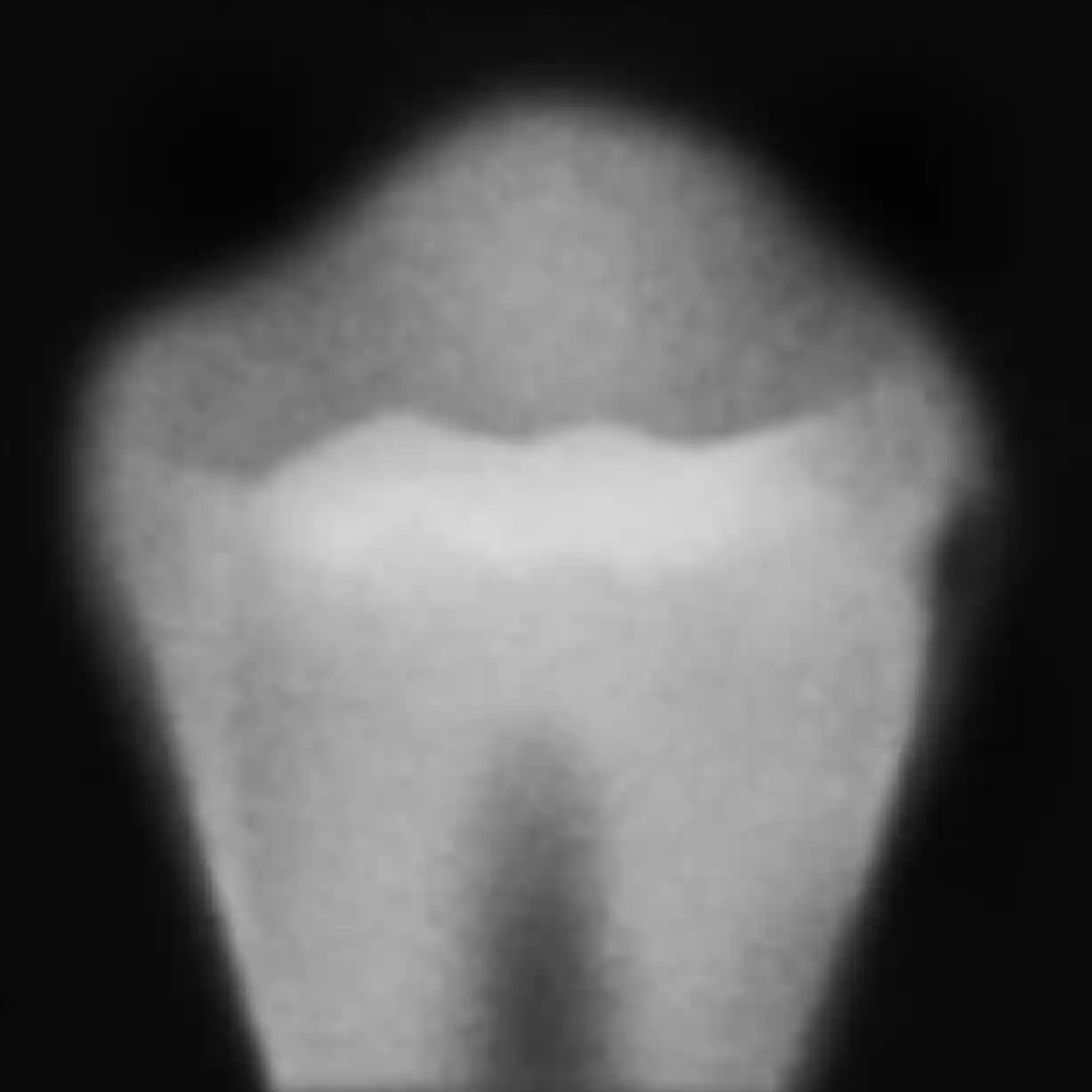hull i tennene grad 1