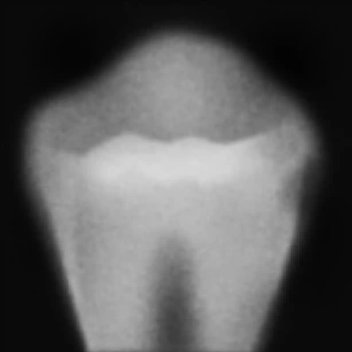 hull i tennene grad 2
