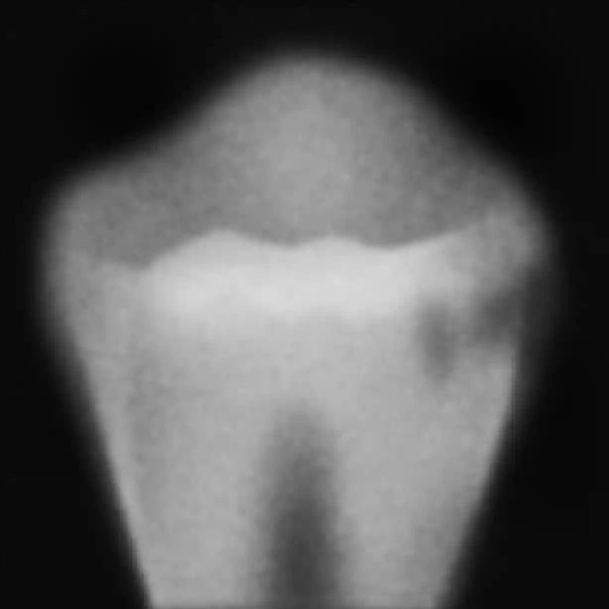 hull i tennene grad 3