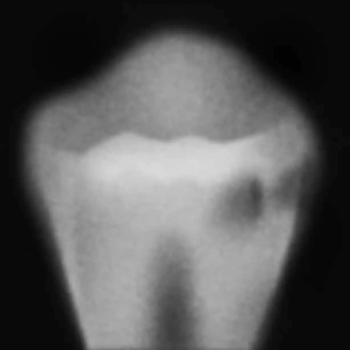 hull i tennene grad 5
